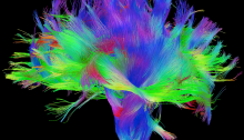 Brain Neuro Fibers